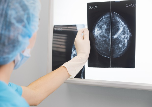 Pit Salute, nella Sanità pubblica 13 mesi di attesa per una mammografia © Ansa