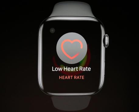 Cardiologi Usa valutano sensore per il cuore Apple Watch © ANSA