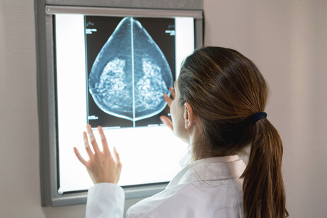 Schillaci, Italia all'avanguardia per le breast unit contro il tumore seno