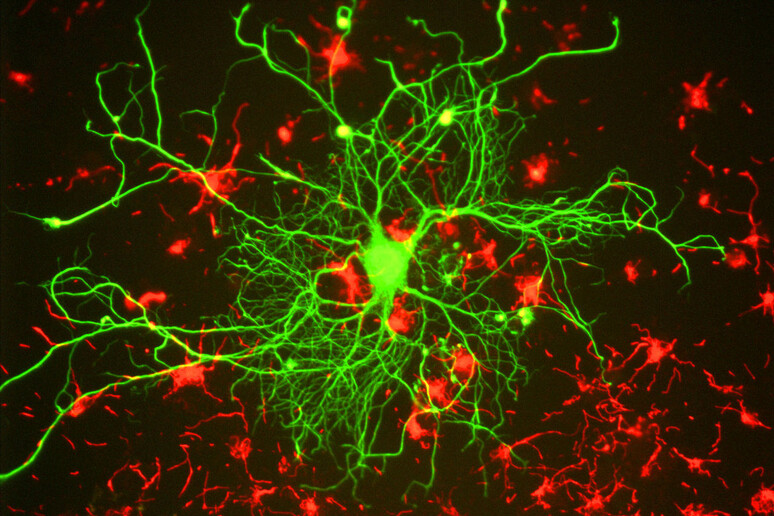 Neuroni della corteccia cerebrale (fonte: GerryShaw) - RIPRODUZIONE RISERVATA