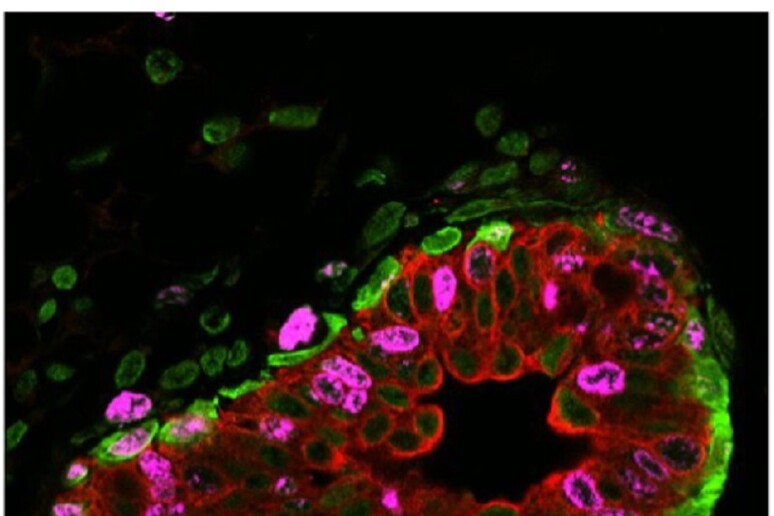 Scoperto l 'interruttore molecolare che riesce a bloccare le staminali del tumore del seno (fonte: IIT) - RIPRODUZIONE RISERVATA