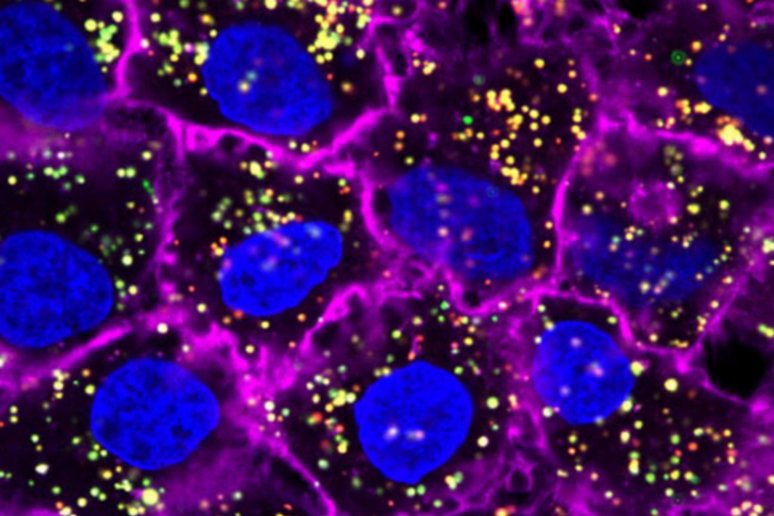 Nanoparticelle d 'oro catturano il Dna dei tumori in circolazione (fonte: Wikipedia) - RIPRODUZIONE RISERVATA