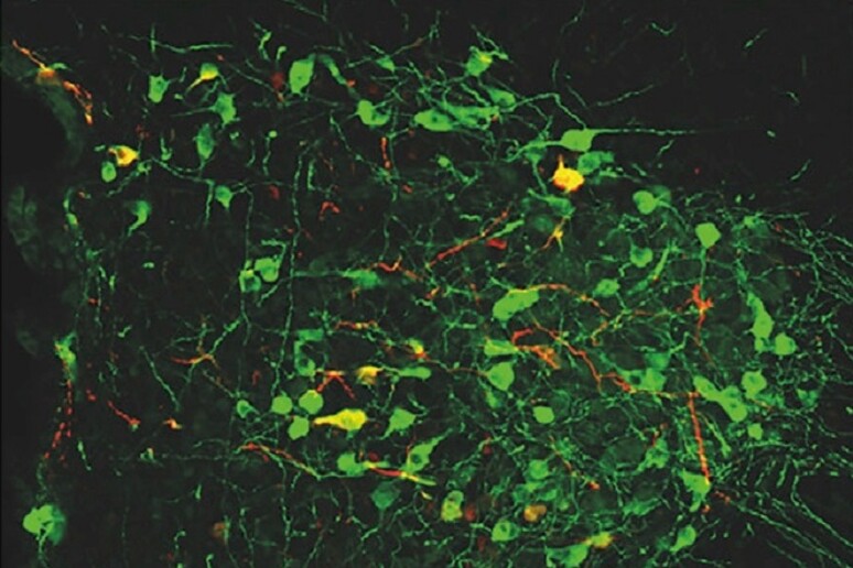 Cellule nervose coinvolte nell 'espressione della paura (fonte: NICO, Università di Torino) - RIPRODUZIONE RISERVATA