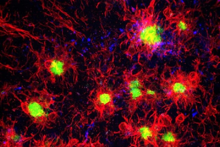 In rosso la microglia e in verde le placche di amiloide in un cervello con Alzheimer (fonte: Kim Green Lab/UCI) - RIPRODUZIONE RISERVATA