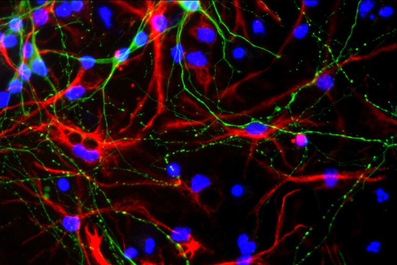 Ringiovanite le cellule progenitrici dei neuroni del cervello (fonte: Gotoh laboratory of molecular biology CC-BY) - RIPRODUZIONE RISERVATA