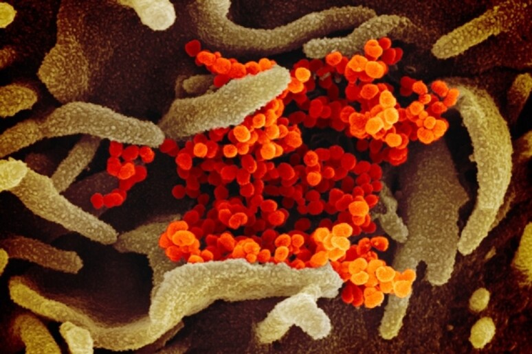 In arancione le particelle virali di SarsCoV2 che emergono da cellule coltivate in laboratorio (fonte: NIAID-RML) - RIPRODUZIONE RISERVATA
