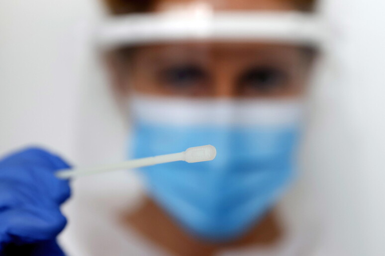 Un test rapido èermette di riconoscere l 'infezione da coromavirus dall 'influenza © ANSA/EPA