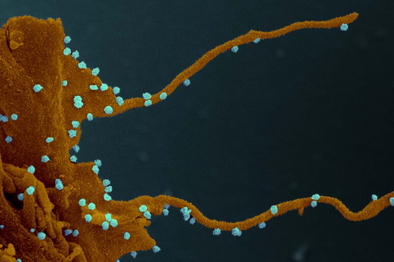 Particelle del virus SarsCoV2 sulla superficie di una cellula con filopodi (fonte: Elizabeth Fischer, Microscopy Unit NIH/NIAID) - RIPRODUZIONE RISERVATA