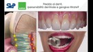 Sidp, cos'e' e come si puo' affrontare l'ipersensibilita' dentale (ANSA)