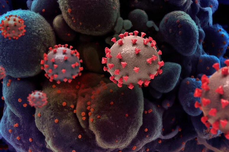 Particelle del virus SarsCoV2 su cellule (fonte: NIAID) - RIPRODUZIONE RISERVATA