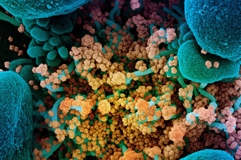 Particelle del virus SarsCoV2nsu una cellula (fonte: NIAID) - RIPRODUZIONE RISERVATA