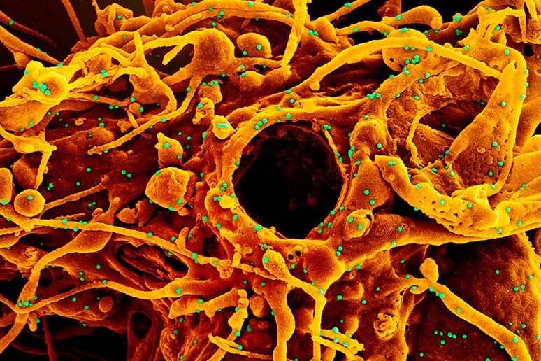 Particelle di coronavirus su una cellula (fonte: NIAIDNIHSPL) - RIPRODUZIONE RISERVATA