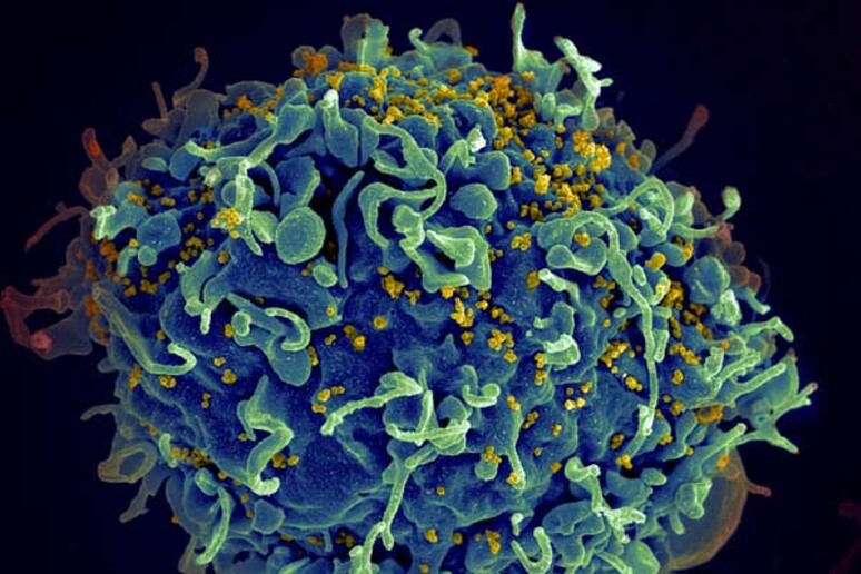 Un linfocita T attaccato dal virus HIV, evidenziato in giallo (fonte: S. Pincus, E. Fischer, A. Athman, National Institute of Allergy and Infectious Diseases/NIH) - RIPRODUZIONE RISERVATA